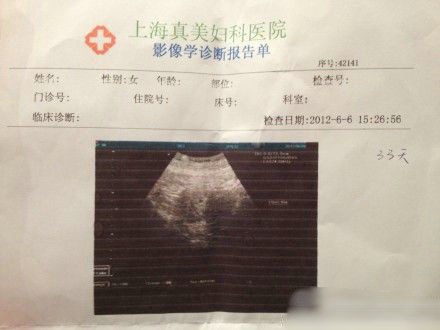 袁莉老公曝妻懷孕一月,曬其B超照。