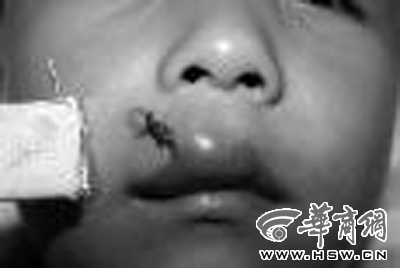 陜西幼兒園老師向4歲男童扔寫(xiě)字板