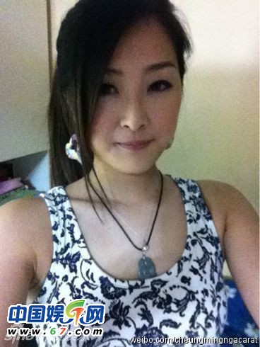 有人爆料指張名雅做過(guò)四次整形手術(shù)，還提供了一張疑似張名雅的舊照(左圖)