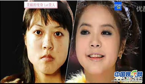 多圖劇透韓國(guó)整容節(jié)目《LET 美人》近幾期，最愛小V臉，人瘦就能美