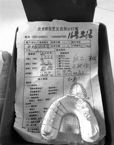 精佳藝義齒加工訂單顯示“反（返）工、重做”等字樣，一名骨干業(yè)務(wù)員說，該廠產(chǎn)品返工率占兩成。