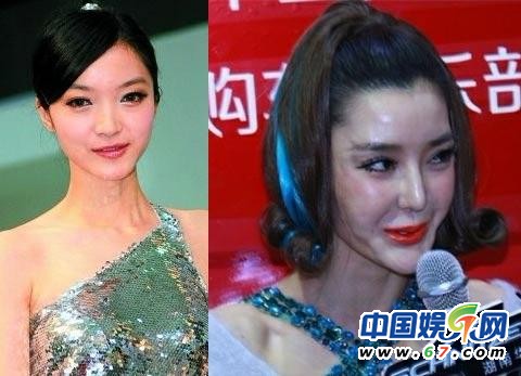 李穎芝整容前清楚照曝光 網友：鄰家小妹變蛇妖