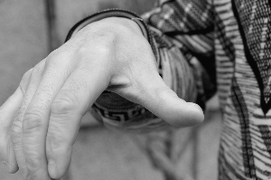 高和力受傷的大拇指下方的肌肉萎縮了 本報記者 畢繼紅 攝