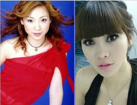 史上最全女主播整容前后對比照 網(wǎng)友：膜拜柳巖