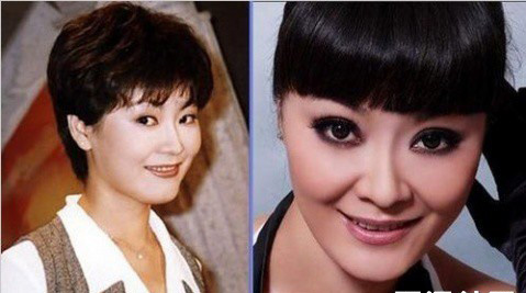 史上最全女主播整容前后對比照 網(wǎng)友：膜拜柳巖