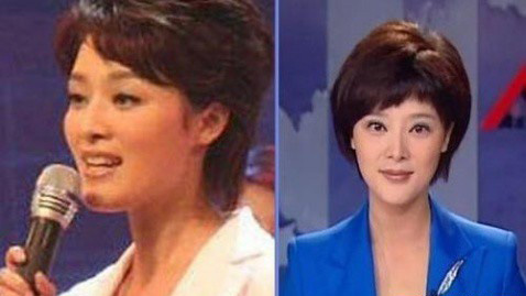 史上最全女主播整容前后對比照 網友：膜拜柳巖