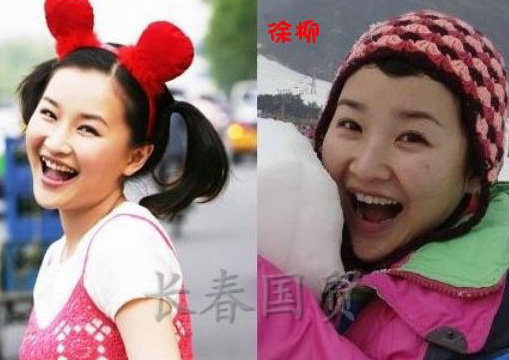 史上最全女主播整容前后對(duì)比照 網(wǎng)友：膜拜柳巖