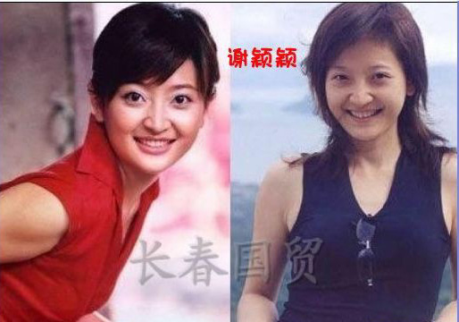 史上最全女主播整容前后對(duì)比照 網(wǎng)友：膜拜柳巖
