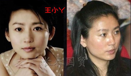史上最全女主播整容前后對(duì)比照 網(wǎng)友：膜拜柳巖