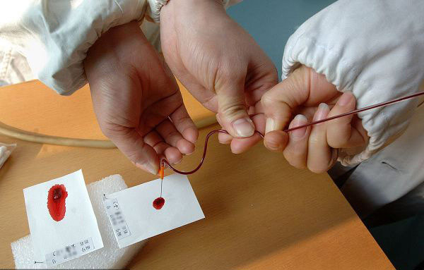 DNA親子鑒定全過程實(shí)拍