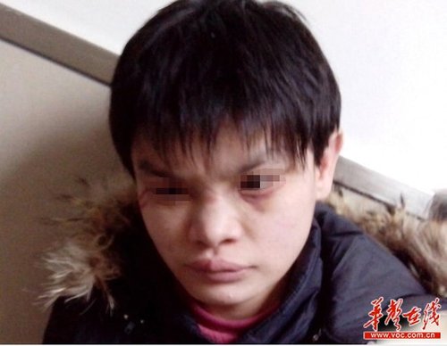近日，十堰市兒童福利院被曝虐待兒童，其中7名兒童在2012年冬季被活活凍死，引發(fā)廣泛關(guān)注。 網(wǎng)絡(luò)截圖