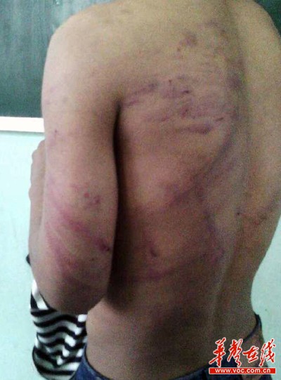 目前被體罰學生已經回校上課，涉事老師被責令道歉。網絡截圖