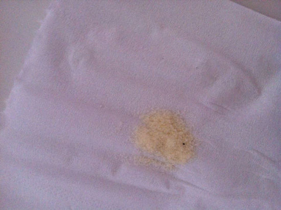 消費者在美贊臣奶粉中吃出的黑色異物 